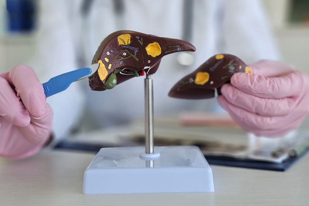 Hepatobiliary and pancreatic cancer surgery