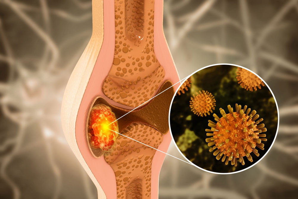 Soft tissue and bone cancer surgery